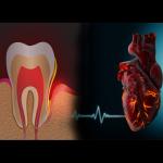 The Surprising Link Between Oral Health and Heart Health