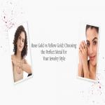 This or That: Rose Gold vs White Gold vs Yellow Gold – Which One is Right for You!