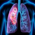 The Impact of Air Quality on Health: Protecting Your Family During Environmental Hazards