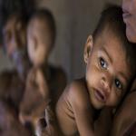 Understanding Growth Faltering: Differentiating Slow Growth from Malnutrition