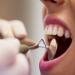 Health Benefits of Having Dental Care Every 6 Months