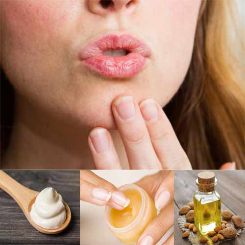Tips to keep lips smooth and soft in winters, tips to keep lips smooth and soft in winters,  how to keep lips smooth and soft in winters,  ways to treat chapped lips,  home remedies for dry lips,  tips to make dry lips smooth,  ifairer