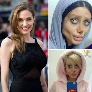 Amazing! A women undergoes 50 surgeries to look like Angelina Jolie
