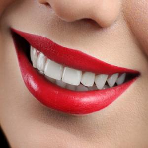 Study: Whitening Products May Cause Tooth Decay