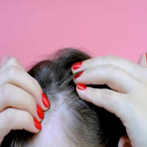 How to Stop Hair Fall Naturally: Effective Remedies and Tips
