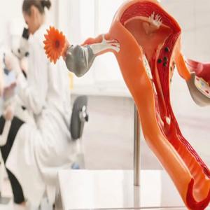 Home Remedies to Manage Endometriosis Naturally: Gentle Support for Your Body