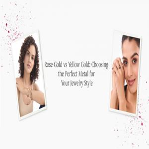 This or That: Rose Gold vs White Gold vs Yellow Gold – Which One is Right for You!
