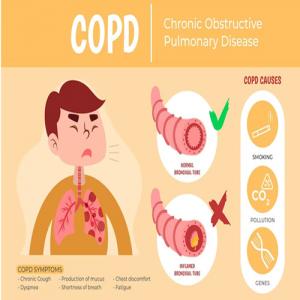Chronic Obstructive Pulmonary Disease (COPD): Understanding and Managing a Long-Term Lung Condition