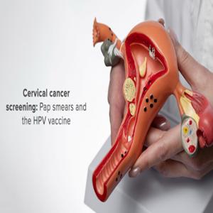 Screening and Prevention: Why HPV Vaccination, Pap Smears, and Breast Exams Matter