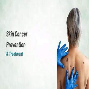 Skin Cancer Prevention: Simple Daily Habits That Can Protect Your Skin for Life